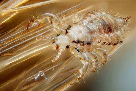 Bestand:Male human head louse.jpg - Wikipedia