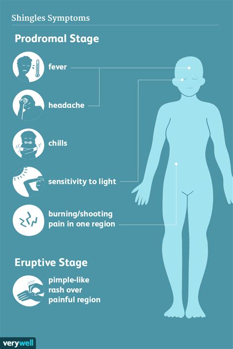 How Shingles Is Treated