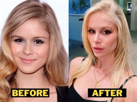 Erin Moriarty Have Eating Disorder? Surgery Before After Pic