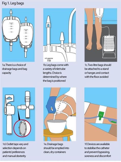 Urinary catheters 3: catheter drainage and support systems | Nursing Times | Catheter, Catheter ...