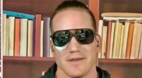 A.J. Hawk Showed off His Eye Injury During The Pat McAfee Show