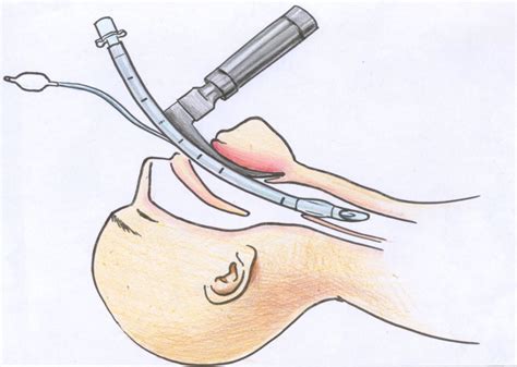 ACLS YANJIV.pptx on emaze