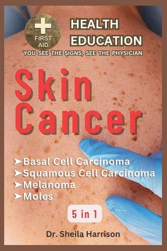 Skin Cancer: Basal Cell Carcinoma, Squamous Cell Carcinoma, Melanoma Skin Cancer, Mole: Types ...