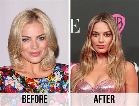 Has Margot Robbie Had Any Plastic Surgery? Doctors Weigh In