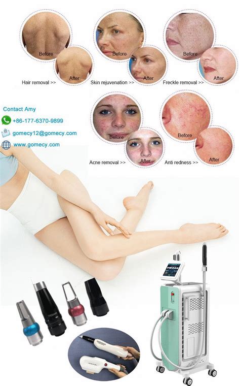 Hair Removal Machine, Hair Removal Device, Ipl Hair Removal, Pulse ...