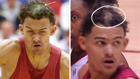 Trae Young Hair (Detailed Look) | Heartafact