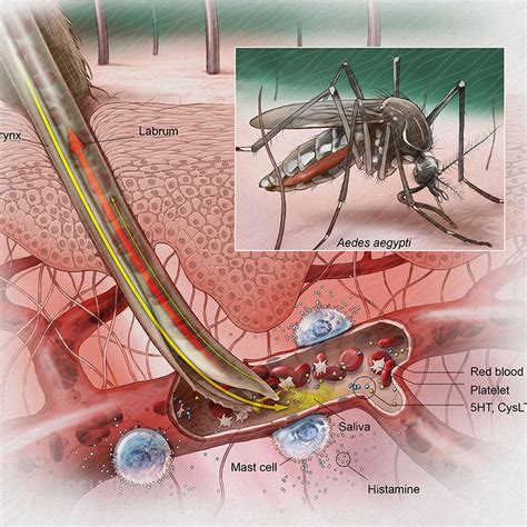 Mosquitos Bites - Prevention - Philadelphia Homeopathic Clinic