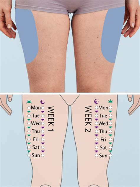 Subcutaneous Injection Sites