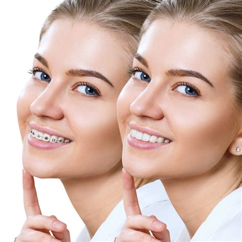 Getting Your Braces Removed Soon? Here’s What to Expect