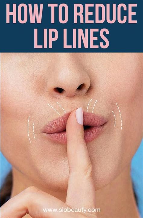 How to Get Rid of Smoker’s Lines: Easy Steps for Smooth Lips | How to ...