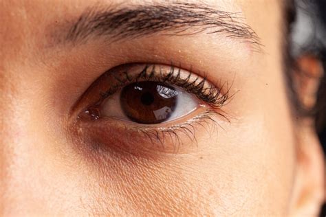 What to Know About Having Brown Eyes - Vision Center