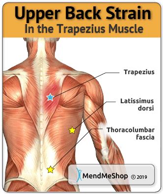 How To Deal With A Pulled Muscle - Devicestructure13