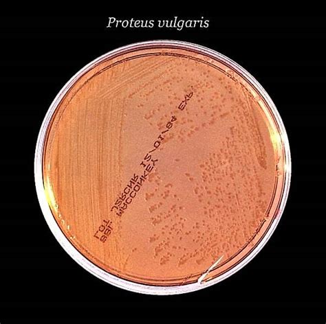 Proteus Mirabilis Colony Morphology On Nutrient Agar | nutrienkarbo