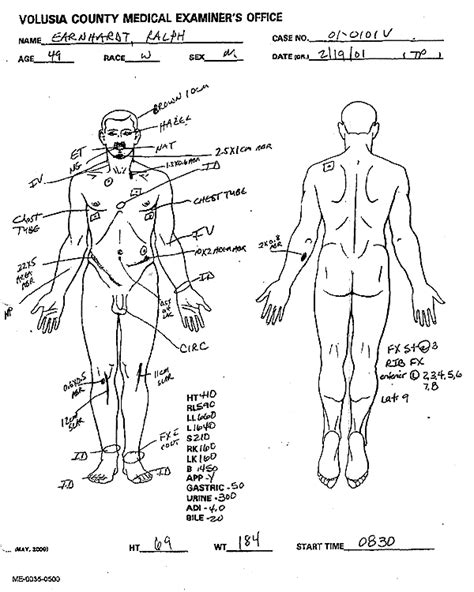 Dale Earnhardt Autopsy Report | The Smoking Gun