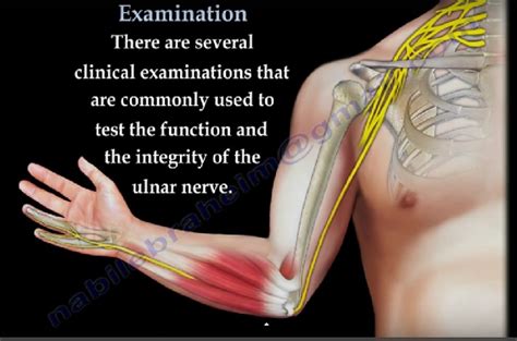 Ulnar Nerve-Clinical Examination — OrthopaedicPrinciples.com