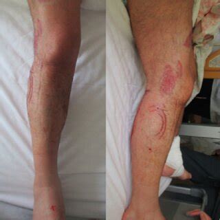 Appearance at the time of transportation. A bruise is visible on the... | Download Scientific ...