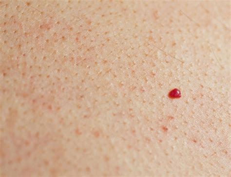 Pinpoint red dots on skin causes - tdfreeloads