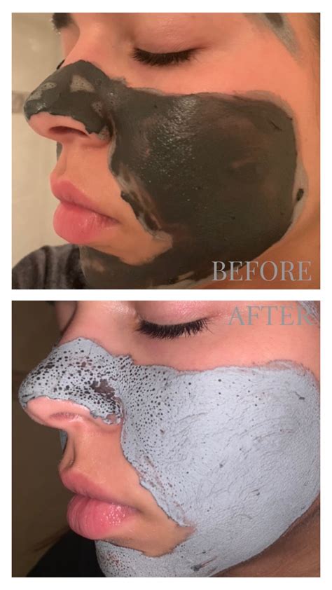 [REVIEW] Glamglow Supermud Clearing Treatment Mask (Before and After) — DEWILDESALHAB武士