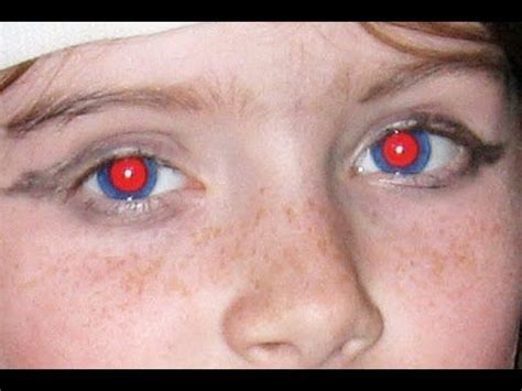 photoshop cs6 remove red eye tool | Red eye photo, Red eyes, Photo editing tricks