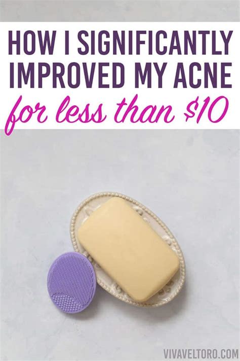 The Best Treatment For Adult Acne. How I Significantly Improved My Acne For Less Than $10 ...