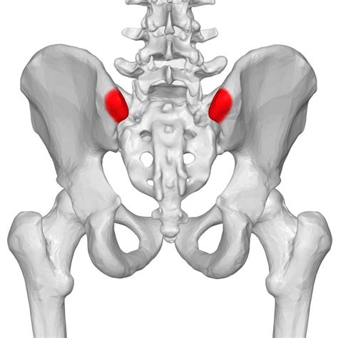 Sacroiliac Joint Dysfunction - Spine - Orthobullets