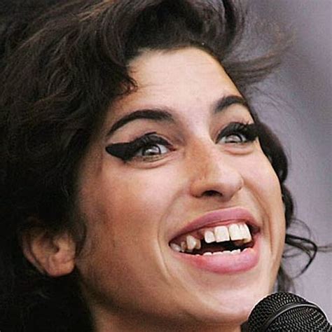 Celebrities With Weird Teeth