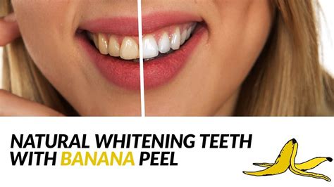 WHITEN YOUR TEETH WITH BANANA PEEL IN JUST 2 DAYS - YouTube