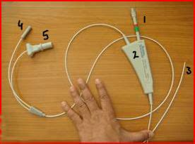 Gastroenterology Education and CPD for trainees and specialists » Gold probe