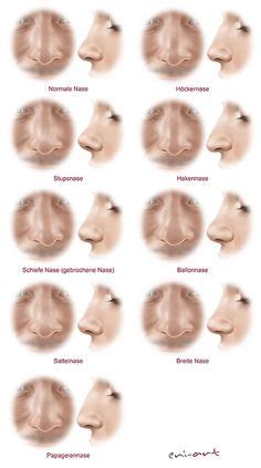 Eastern European nose often has a "wave" and a bulbous tip. Non ...