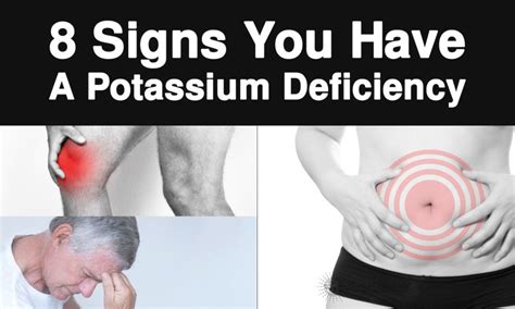 8 Signs You Have A Potassium Deficiency | Potassium deficiency, Vitamin deficiency, Minerals for ...