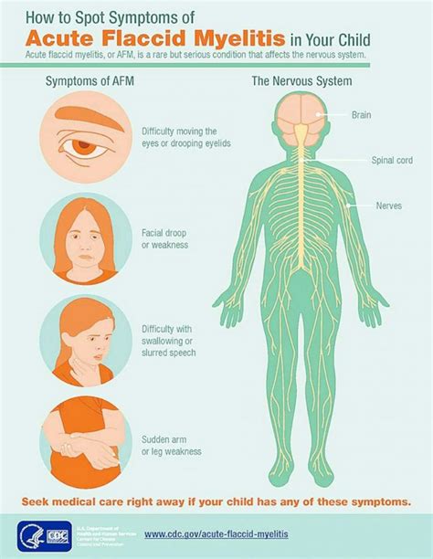 CDC Doctors Say Mysterious Illness, Acute Flaccid Myelitis, Is on the Rise | Inverse