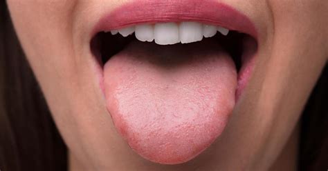 What Causes Sore Mouth Tongue And Lips | Lipstutorial.org