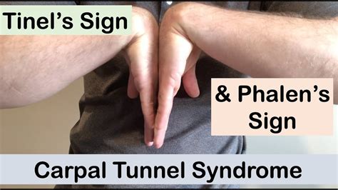 Carpal tunnel syndrome | Tinel’s sign and Phalen’s sign | Clinical Examination - YouTube