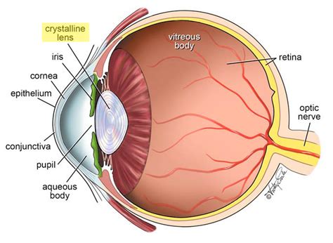 Refractive Lens Exchange – A Great Answer for Aging Eyes - Vancouver Eye Surgery