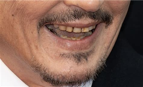 Johnny Depp’s teeth visibly rotting, fans react in disgust