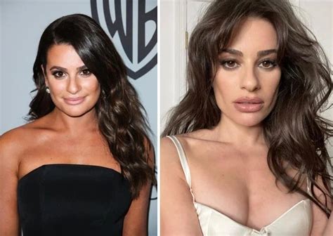 Lea Michele Before and After Plastic Surgery: Nose, Face, Boob