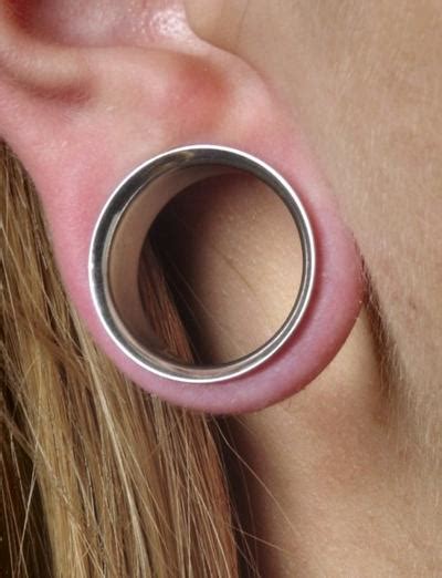 'Fixing' an ear gauge may require surgery | Lifestyle | lancasteronline.com