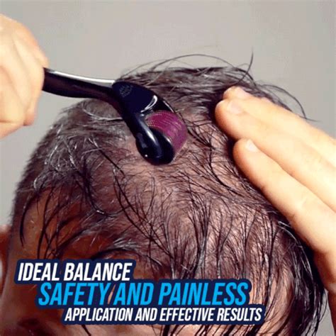 HAIR RE-ACTIVATING ROLLER – Redbovi.com in 2021 | Hair loss treatment, Hair, Hair growth serum