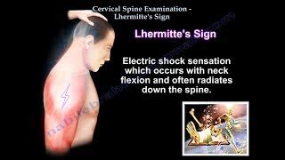 Cervical Spine Examination Lhermitte's Sign - Everythin... | Doovi