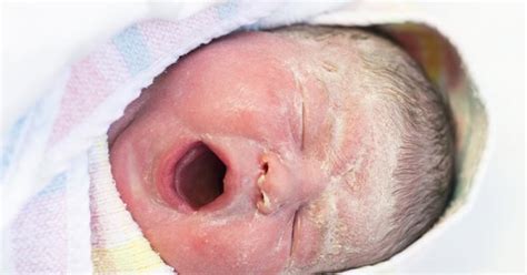 Vernix caseosa : mais a quoi sert vraiment cette substance étrange ? - Magicmaman.com