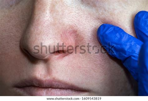 1,314 Bruise Nose Stock Photos, Images & Photography | Shutterstock