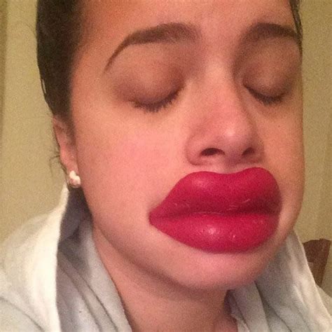 20 Reasons Why You Shouldn’t Try The Kylie Jenner Lip Challenge