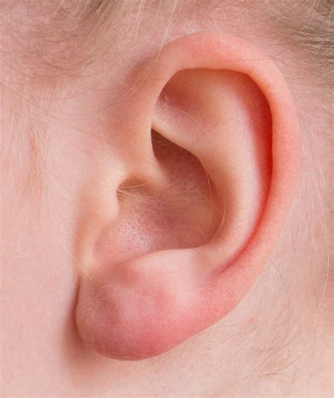 Ear Auricle Listen · Free photo on Pixabay
