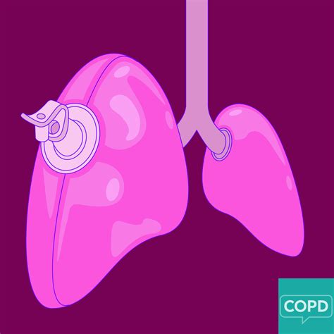 Lung Hyperinflation in COPD | Copd, Lunges, Chronic obstructive pulmonary