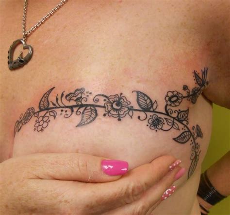 Lumpectomy Tattoos