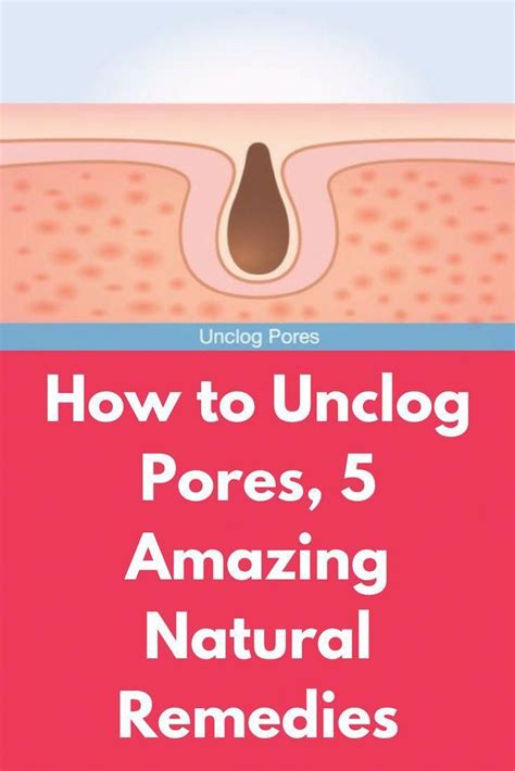 How to Unclog Pores 5 Amazing Natural Remedies Pores are present all over the s #AcneScarsMask ...