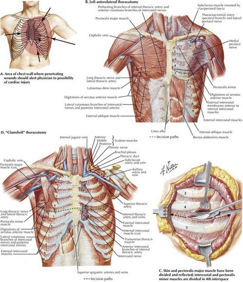 Emergency Thoracotomy for Trauma | Basicmedical Key