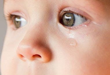 Tear Leak-Watering Eyes-Congenital Dacryocystitis - Prof. Dr. Tamer DEMİR