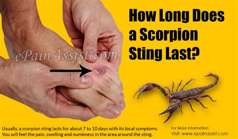 How Long Does a Scorpion Sting Last & what To Do If You Get Stung By a Scorpion?