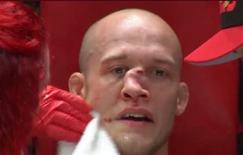 MMA fighter suffers horrific nose break and still finishes round after ...